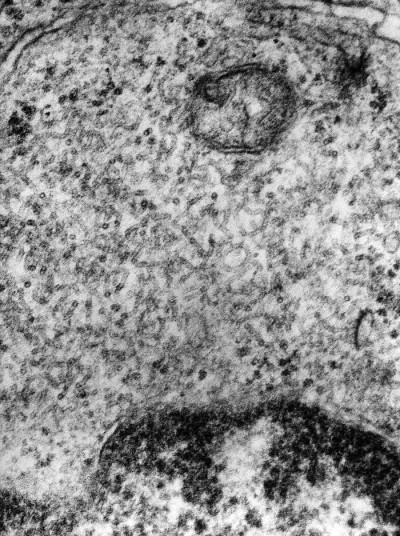 Transmission Electron Micrograph of Paramyxovirus