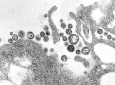 Transmission Electron Micrograph of Lassa Virus