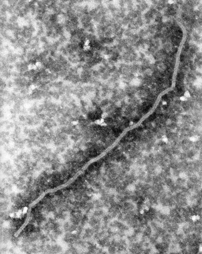 Ultrastructural Details of a Nipah Virus Nucleocapsid