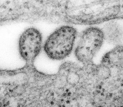 Transmission Electron Micrograph of Lassa Virus