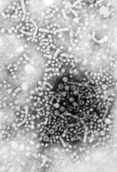 Transmission Electron Micrograph of Hepatitis B Virus