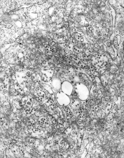 Transmission Electron Micrograph of Russian Spring-Summer Encephalitis Virions