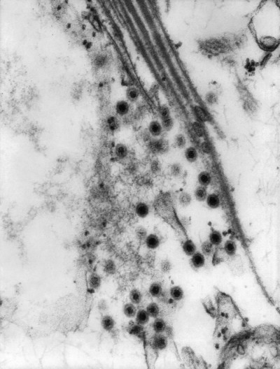 Transmission Electron Micrograph of Colorado Tick Fever Virus