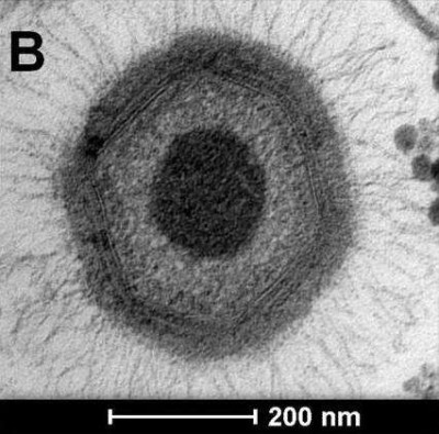 Niemeyer Virus