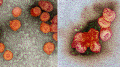 Colored Pseudomonas Virus Phi6 Virions