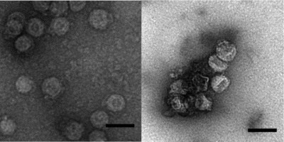 Virions of Pseudomonas Virus Phi6