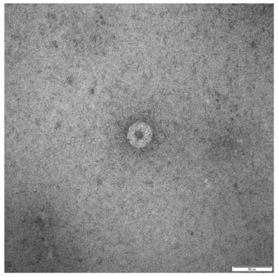 Transmission Electron Micrograph of Palm Creek Virus Particles