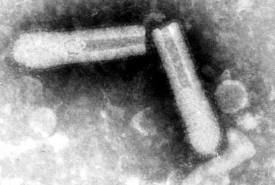 Transmission Electron Micrograph of Plant Rhabdovirus