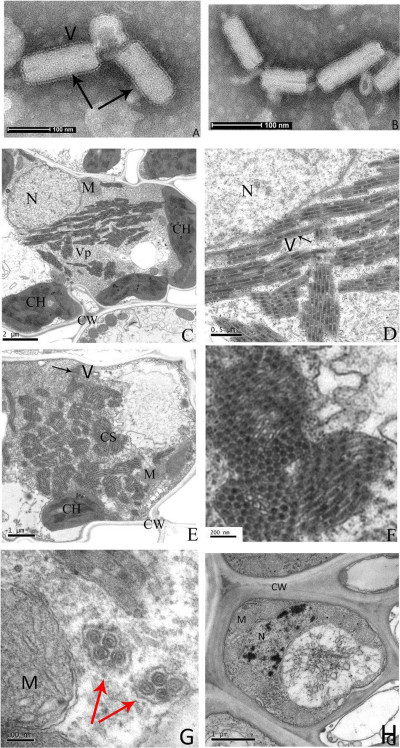 Electron Micrograph of Infected Rice Leaves