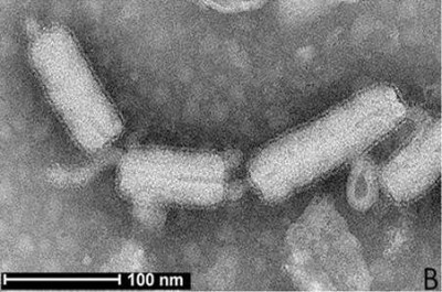 Electron Micrograph of Rice Stripe Mosaic Virus