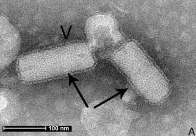 Electron Micrograph of Rice Stripe Mosaic Virus