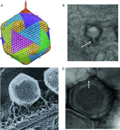 Visual Descriptions of Viral Structures in Cryo-Electron Micrographs