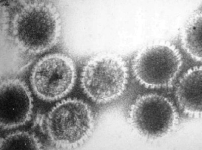 Electron Micrograph of Herpes Virus