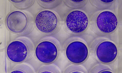 Plaque Assay Dilution Series