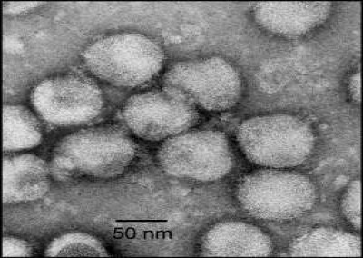 Electron Micrograph of NDiV Virions