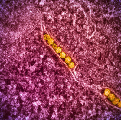 Transmission Electron Micrograph of West Nile Virus