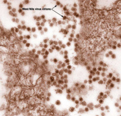 Digitally-Colorized Transmission Electron Microscopic Image of WNV Virions