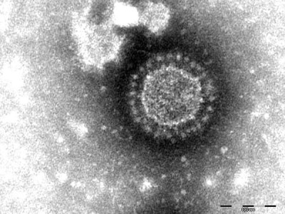 Porcine Epidemic Diarrhea Virus Particles Seen by Electron Microscopy