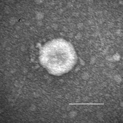 Porcine Deltacoronavirus Particle