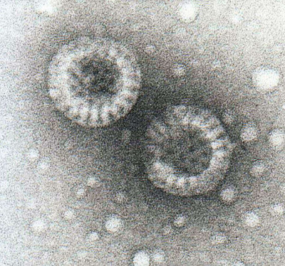 Electron Micrograph of Two Rotavirus Particles