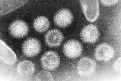 Transmission Electron Micrograph of Rotavirus