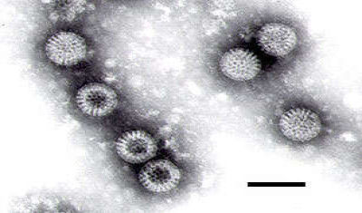 Negative-Stain Transmission Electron Micrograph of Rotavirus Particles