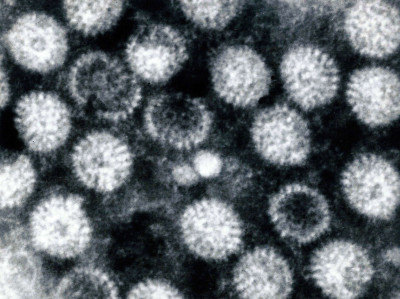 Negatively Stained Electron Micrograph of Rotaviruses