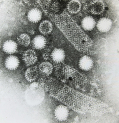 Epizootic Diarrhoea Virus of Mice (EDIM)