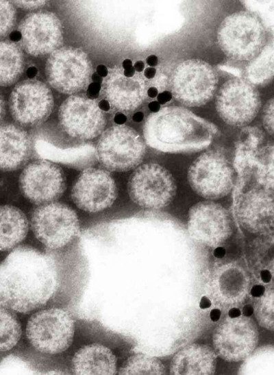 Rotavirus with Gold-Labelled Monoclonal Antibody