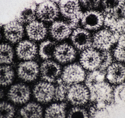 Electron Micrography of Rotaviruses