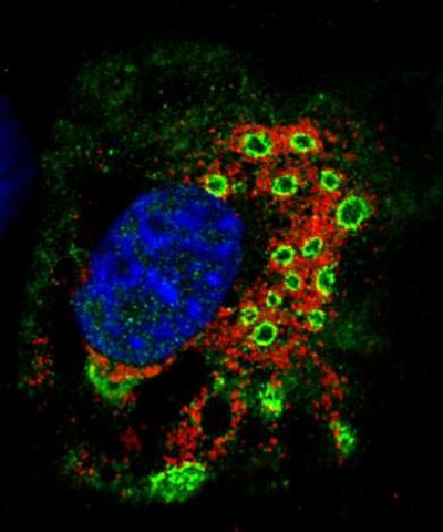 Rotavirus-Infected Cell