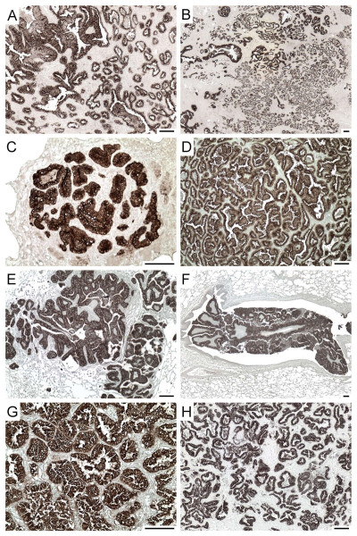 Mab Staining of JSRV-Infected Sheep Lung Tumors