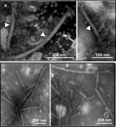 Morphology of Sclerotinia Sclerotiorum Negative-Stranded RNA Virus 1