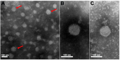 Pteromalus Puparum Negative-Strand RNA Virus 1 Particles