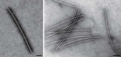 Sulfolobus Islandicus Rod-Shaped Viruses SIRV5 and SIRV8