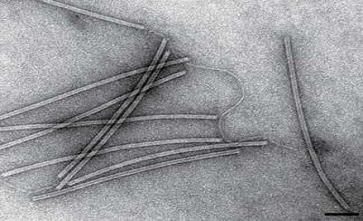 Sulfolobus Islandicus Rod-Shaped Viruses SIRV8