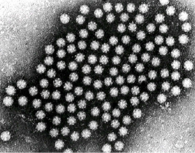 Human Astrovirus Particles