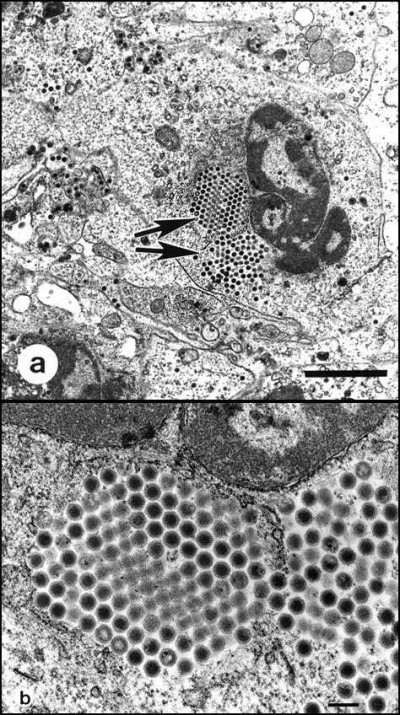 Transmission Electron Micrographs of Iridovirus