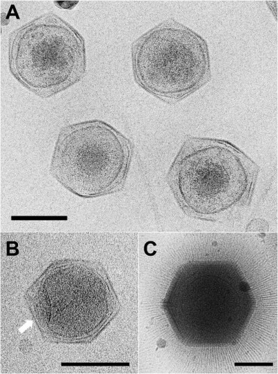 Cryo-Electron Micrograph Images of CroV Compared to APMV