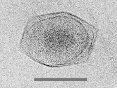 Cryo-Electron Micrograph of CroV Particle