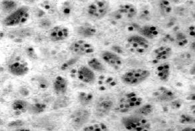 Virus Particles of Glyptapanteles indiensis Polydnavirus