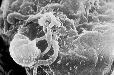 Scanning Electron Microscopic Image of HIV-Budding