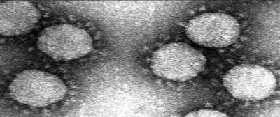 Electron Microscopy Images of Concentrated Transmissible Gastroenteritis Coronavirus