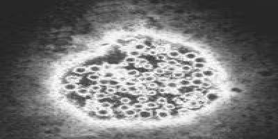 Hepatovirus