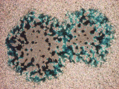 Viral LacZ Gene Expression