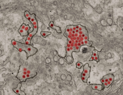 Zika Virus Particles Shown in African Green Monkey Kidney Cells