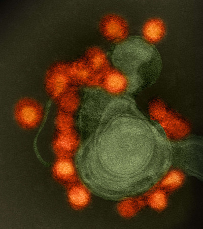 Transmission Electron Microscope Image of Negative-Stained Zika Virus