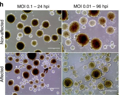 Neuroshperes with ZIKV Infection