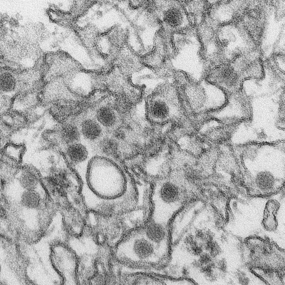 Transmission Electron Micrograph of Zika Virus