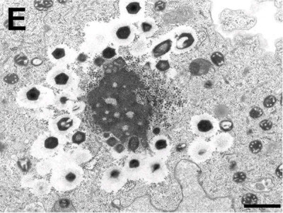 Zamilon Virophage with Mont1